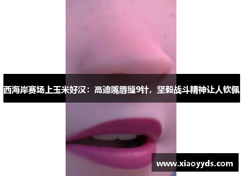 西海岸赛场上玉米好汉：高迪嘴唇缝9针，坚毅战斗精神让人钦佩